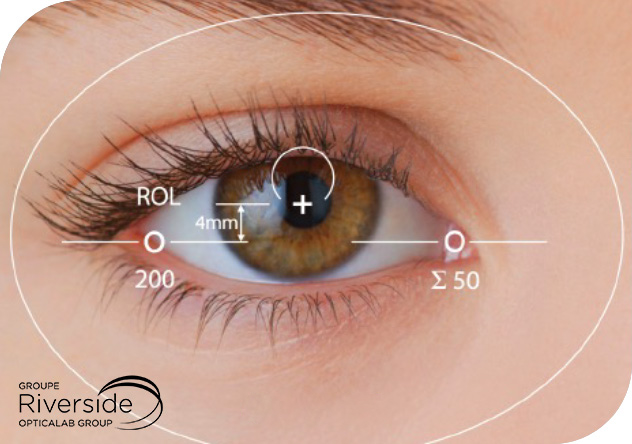 L'image est un gros plan d'un œil humain, avec diverses mesures et étiquettes superposées. L'œil est centré dans le cadre, avec l'iris visible et la pupille au centre. Les cils sont longs et foncés, et la peau environnante est claire
